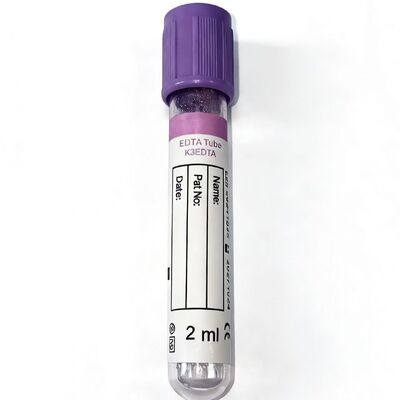 Whole Blood EDTA Tubes: Essential for Hematology & Molecular Test Integrity