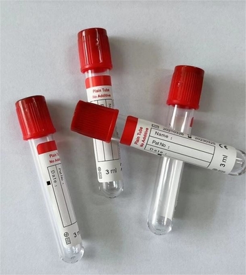 매끄러운 내부 튜브 벽은 평면 진공 혈액 수집 튜브에서 혈액 세포 부착을 방지 1ml-10ml