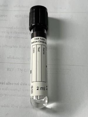1.6ml ESR 진공 튜브 침착률을 위해 3.8% 나트륨 시트라트