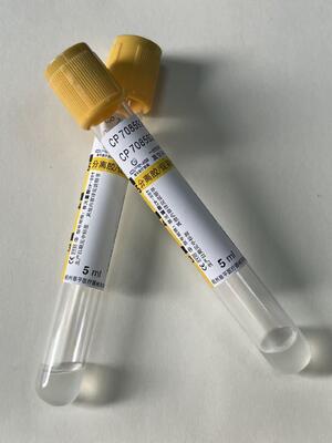 혈소 분리 튜브 (SST) 는 응고 활성화 장치와 젤 장벽이 있습니다.