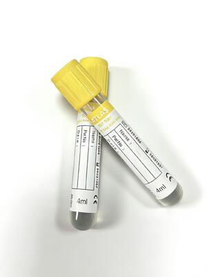SST 진공 튜브: 핵 연구소용 급속한 혈청 응고 및 우수한 분리